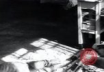 Image of Tuberculosis of bone and skin Vienna Austria, 1923, second 15 stock footage video 65675027118