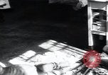 Image of Tuberculosis of bone and skin Vienna Austria, 1923, second 16 stock footage video 65675027118
