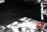 Image of Tuberculosis of bone and skin Vienna Austria, 1923, second 17 stock footage video 65675027118
