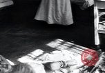 Image of Tuberculosis of bone and skin Vienna Austria, 1923, second 20 stock footage video 65675027118