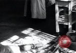 Image of Tuberculosis of bone and skin Vienna Austria, 1923, second 22 stock footage video 65675027118