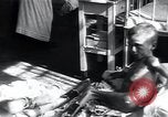 Image of Tuberculosis of bone and skin Vienna Austria, 1923, second 26 stock footage video 65675027118