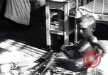 Image of Tuberculosis of bone and skin Vienna Austria, 1923, second 27 stock footage video 65675027118