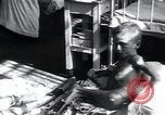 Image of Tuberculosis of bone and skin Vienna Austria, 1923, second 28 stock footage video 65675027118