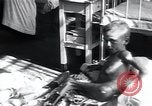 Image of Tuberculosis of bone and skin Vienna Austria, 1923, second 29 stock footage video 65675027118