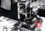 Image of Tuberculosis of bone and skin Vienna Austria, 1923, second 30 stock footage video 65675027118