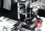 Image of Tuberculosis of bone and skin Vienna Austria, 1923, second 31 stock footage video 65675027118