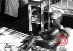 Image of Tuberculosis of bone and skin Vienna Austria, 1923, second 32 stock footage video 65675027118