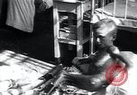 Image of Tuberculosis of bone and skin Vienna Austria, 1923, second 33 stock footage video 65675027118