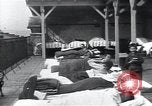 Image of Tuberculosis of bone and skin Vienna Austria, 1923, second 48 stock footage video 65675027118