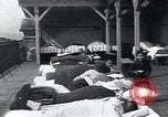 Image of Tuberculosis of bone and skin Vienna Austria, 1923, second 49 stock footage video 65675027118