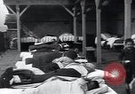 Image of Tuberculosis of bone and skin Vienna Austria, 1923, second 50 stock footage video 65675027118