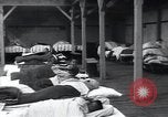 Image of Tuberculosis of bone and skin Vienna Austria, 1923, second 51 stock footage video 65675027118
