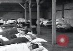 Image of Tuberculosis of bone and skin Vienna Austria, 1923, second 52 stock footage video 65675027118