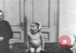 Standbild Kinder mit Rachitis Wien Österreich, 1923, aus Sekunde 40 historischem Filmmaterial Videoclip 65675027120