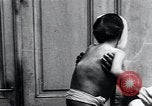 Standbild Kinder mit Rachitis Wien Österreich, 1923, aus Sekunde 52 historischem Filmmaterial Videoclip 65675027120