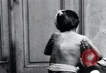 Standbild Kinder mit Rachitis Wien Österreich, 1923, aus Sekunde 53 historischem Filmmaterial Videoclip 65675027120