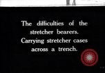 Image brancardiers ont certaines difficultés France, 1917, de la seconde 1 séquences d'archives historiques vidéo 65675027241