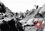 Image brancardiers ont certaines difficultés France, 1917, de la seconde 9 séquences d'archives historiques vidéo 65675027241