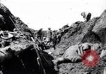 Image brancardiers ont certaines difficultés France, 1917, de la seconde 10 séquences d'archives historiques vidéo 65675027241
