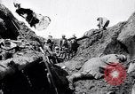 Image brancardiers ont certaines difficultés France, 1917, de la seconde 13 séquences d'archives historiques vidéo 65675027241