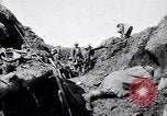 Image brancardiers ont certaines difficultés France, 1917, de la seconde 14 séquences d'archives historiques vidéo 65675027241