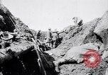 Image brancardiers ont certaines difficultés France, 1917, de la seconde 15 séquences d'archives historiques vidéo 65675027241