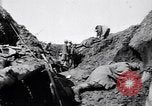 Image brancardiers ont certaines difficultés France, 1917, de la seconde 17 séquences d'archives historiques vidéo 65675027241