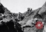Image brancardiers ont certaines difficultés France, 1917, de la seconde 18 séquences d'archives historiques vidéo 65675027241