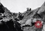Image brancardiers ont certaines difficultés France, 1917, de la seconde 19 séquences d'archives historiques vidéo 65675027241