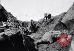 Image brancardiers ont certaines difficultés France, 1917, de la seconde 20 séquences d'archives historiques vidéo 65675027241