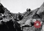 Image brancardiers ont certaines difficultés France, 1917, de la seconde 21 séquences d'archives historiques vidéo 65675027241