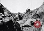 Image brancardiers ont certaines difficultés France, 1917, de la seconde 22 séquences d'archives historiques vidéo 65675027241