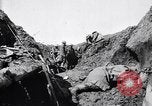 Image brancardiers ont certaines difficultés France, 1917, de la seconde 24 séquences d'archives historiques vidéo 65675027241