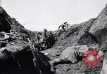 Image brancardiers ont certaines difficultés France, 1917, de la seconde 25 séquences d'archives historiques vidéo 65675027241