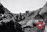Image brancardiers ont certaines difficultés France, 1917, de la seconde 28 séquences d'archives historiques vidéo 65675027241
