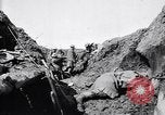 Image brancardiers ont certaines difficultés France, 1917, de la seconde 33 séquences d'archives historiques vidéo 65675027241