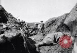 Image brancardiers ont certaines difficultés France, 1917, de la seconde 35 séquences d'archives historiques vidéo 65675027241