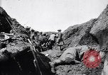 Image brancardiers ont certaines difficultés France, 1917, de la seconde 38 séquences d'archives historiques vidéo 65675027241