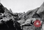 Image brancardiers ont certaines difficultés France, 1917, de la seconde 41 séquences d'archives historiques vidéo 65675027241