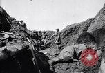Image brancardiers ont certaines difficultés France, 1917, de la seconde 42 séquences d'archives historiques vidéo 65675027241