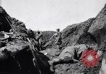 Image brancardiers ont certaines difficultés France, 1917, de la seconde 44 séquences d'archives historiques vidéo 65675027241