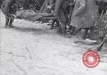 Standbild Verletzte Soldaten auf Bahren Cantigny Frankreich, 1918, aus Sekunde 36 historischem Filmmaterial Videoclip 65675027497