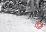 Standbild Verletzte Soldaten auf Bahren Cantigny Frankreich, 1918, aus Sekunde 52 historischem Filmmaterial Videoclip 65675027497