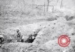 Immagine di Feriti soldati francesi che viene trattata Francia, 1918, secondo 14 filmato di repertorio 65675028096