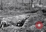 Immagine di Feriti soldati francesi che viene trattata Francia, 1918, secondo 18 filmato di repertorio 65675028096