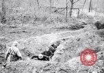 Immagine di Feriti soldati francesi che viene trattata Francia, 1918, secondo 21 filmato di repertorio 65675028096