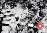Immagine di Feriti soldati francesi che viene trattata Francia, 1918, secondo 48 filmato di repertorio 65675028096