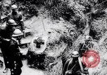 Immagine di Feriti soldati francesi che viene trattata Francia, 1918, secondo 59 filmato di repertorio 65675028096