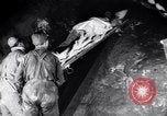 Standbild verletzt Miner's Rescue Franklin New Jersey USA, 1914, aus Sekunde 48 historischem Filmmaterial Videoclip 65675028901